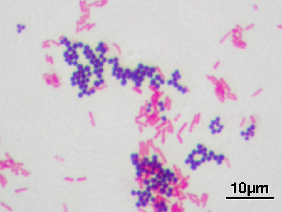 An example of Gram staining